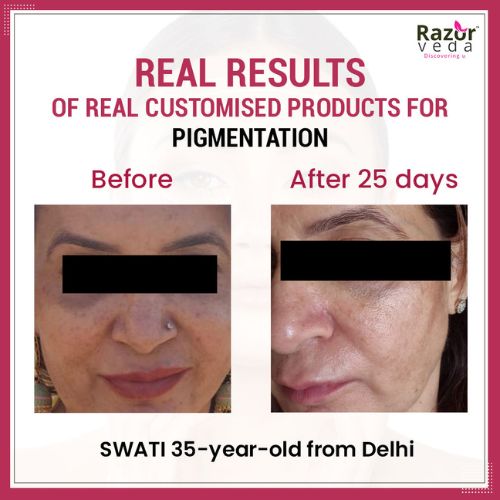 Razorveda | Face Care Customization