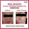 Razorveda | Face Care Customization