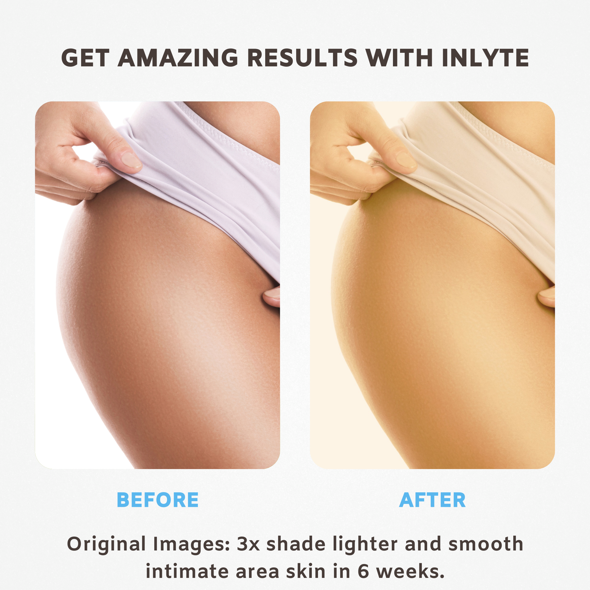 INLYTE Intimate Area Skin Whitening Gel for Dark Inner Thighs, Bikini Area, Underarms & Back Razorveda